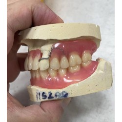 義齒出口 假牙加工廠 義齒外貿(mào) 種植牙出口